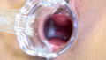 gallery03